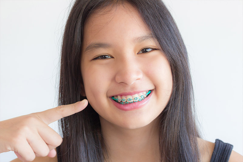 Kids Orthodontics - Bellflower Dentist Orthodontics and Sleep Apnea